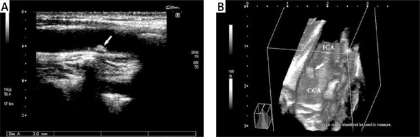 https://www.archivesofmedicalscience.com/f/fulltexts/100416/AMS-16-34612-g001_min.jpg