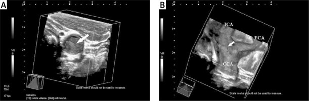 https://www.archivesofmedicalscience.com/f/fulltexts/100416/AMS-16-34612-g002_min.jpg