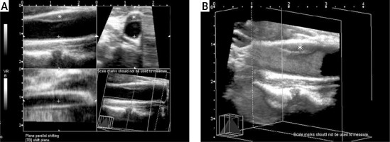 https://www.archivesofmedicalscience.com/f/fulltexts/100416/AMS-16-34612-g003_min.jpg