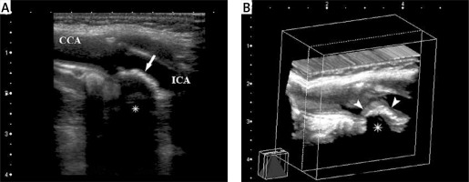 https://www.archivesofmedicalscience.com/f/fulltexts/100416/AMS-16-34612-g005_min.jpg