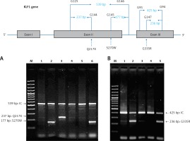 https://www.archivesofmedicalscience.com/f/fulltexts/102712/AMS-18-1-102712-g001_min.jpg