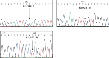 https://www.archivesofmedicalscience.com/f/fulltexts/102712/AMS-18-1-102712-g002_min.jpg