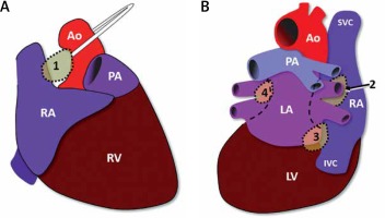 https://www.archivesofmedicalscience.com/f/fulltexts/103607/AMS-17-6-103607-g002_min.jpg