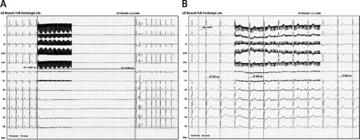 https://www.archivesofmedicalscience.com/f/fulltexts/103607/AMS-17-6-103607-g005_min.jpg