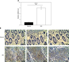 https://www.archivesofmedicalscience.com/f/fulltexts/103609/AMS-17-2-103609-g001_min.jpg