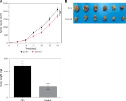 https://www.archivesofmedicalscience.com/f/fulltexts/103609/AMS-17-2-103609-g005_min.jpg