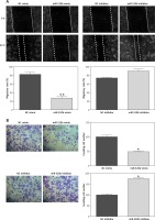 https://www.archivesofmedicalscience.com/f/fulltexts/103660/AMS-17-2-103660-g003_min.jpg