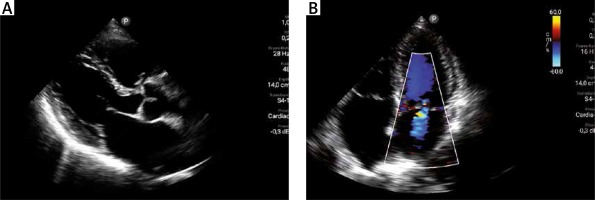 https://www.archivesofmedicalscience.com/f/fulltexts/103863/AMS-18-4-103863-g002_min.jpg