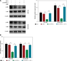 https://www.archivesofmedicalscience.com/f/fulltexts/105347/AMS-17-1-105347-g005_min.jpg