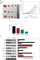 https://www.archivesofmedicalscience.com/f/fulltexts/105347/AMS-17-1-105347-g006_min.jpg