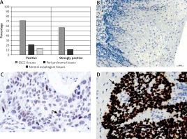 https://www.archivesofmedicalscience.com/f/fulltexts/105491/AMS-17-1-105491-g001_min.jpg