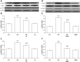 https://www.archivesofmedicalscience.com/f/fulltexts/106206/AMS-17-5-106206-g003_min.jpg