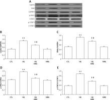 https://www.archivesofmedicalscience.com/f/fulltexts/106206/AMS-17-5-106206-g004_min.jpg