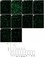 https://www.archivesofmedicalscience.com/f/fulltexts/106206/AMS-17-5-106206-g007_min.jpg