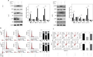 https://www.archivesofmedicalscience.com/f/fulltexts/108624/AMS-17-6-108624-g006_min.jpg