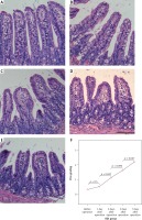 https://www.archivesofmedicalscience.com/f/fulltexts/108641/AMS-18-1-108641-g002_min.jpg