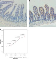 https://www.archivesofmedicalscience.com/f/fulltexts/108641/AMS-18-1-108641-g004_min.jpg