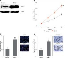 https://www.archivesofmedicalscience.com/f/fulltexts/108673/AMS-17-6-108673-g006_min.jpg