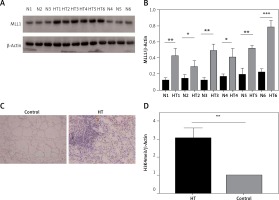 https://www.archivesofmedicalscience.com/f/fulltexts/108683/AMS-18-1-108683-g007_min.jpg