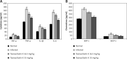 https://www.archivesofmedicalscience.com/f/fulltexts/109139/AMS-16-6-37022-g003_min.jpg