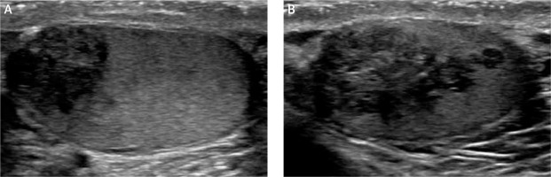 https://www.archivesofmedicalscience.com/f/fulltexts/109627/AMS-16-6-42218-g003_min.jpg