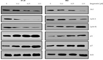 https://www.archivesofmedicalscience.com/f/fulltexts/109643/AMS-18-6-109643-g006_min.jpg