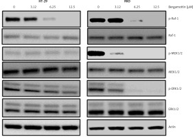 https://www.archivesofmedicalscience.com/f/fulltexts/109643/AMS-18-6-109643-g007_min.jpg