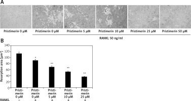 https://www.archivesofmedicalscience.com/f/fulltexts/109853/AMS-18-6-109853-g008_min.jpg