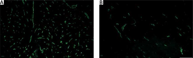 https://www.archivesofmedicalscience.com/f/fulltexts/110052/AMS-18-5-110052-g004_min.jpg