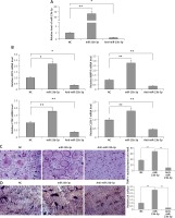 https://www.archivesofmedicalscience.com/f/fulltexts/110286/AMS-18-6-110286-g002_min.jpg