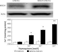 https://www.archivesofmedicalscience.com/f/fulltexts/110287/AMS-19-1-110287-g001_min.jpg