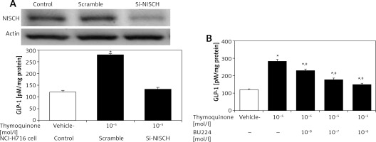 https://www.archivesofmedicalscience.com/f/fulltexts/110287/AMS-19-1-110287-g002_min.jpg