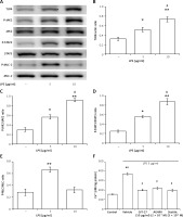 https://www.archivesofmedicalscience.com/f/fulltexts/110461/AMS-19-1-110461-g002_min.jpg