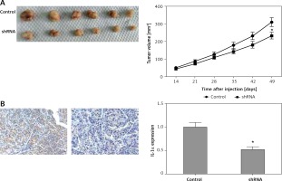 https://www.archivesofmedicalscience.com/f/fulltexts/110521/AMS-19-1-110521-g005_min.jpg