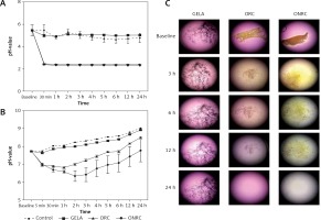 https://www.archivesofmedicalscience.com/f/fulltexts/110918/AMS-19-1-110918-g001_min.jpg