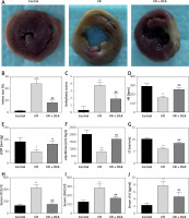 https://www.archivesofmedicalscience.com/f/fulltexts/110948/AMS-19-2-110948-g001_min.jpg