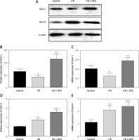 https://www.archivesofmedicalscience.com/f/fulltexts/110948/AMS-19-2-110948-g005_min.jpg