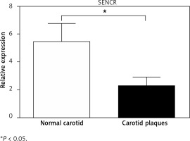 https://www.archivesofmedicalscience.com/f/fulltexts/110951/AMS-19-1-110951-g001_min.jpg