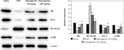 https://www.archivesofmedicalscience.com/f/fulltexts/111137/AMS-19-2-111137-g003_min.jpg