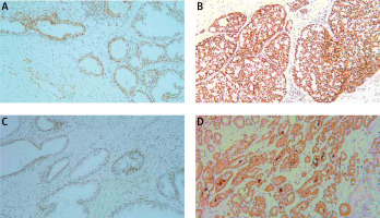 https://www.archivesofmedicalscience.com/f/fulltexts/111514/AMS-19-2-111514-g003_min.jpg