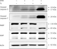 https://www.archivesofmedicalscience.com/f/fulltexts/111947/AMS-19-2-111947-g004_min.jpg