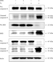 https://www.archivesofmedicalscience.com/f/fulltexts/111947/AMS-19-2-111947-g006_min.jpg