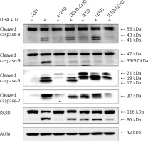 https://www.archivesofmedicalscience.com/f/fulltexts/111947/AMS-19-2-111947-g008_min.jpg