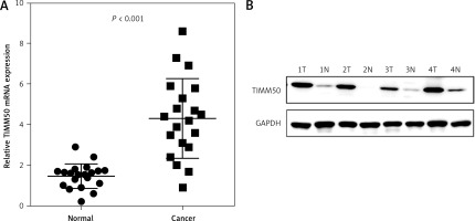 https://www.archivesofmedicalscience.com/f/fulltexts/112316/AMS-19-3-112316-g002_min.jpg