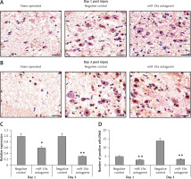 https://www.archivesofmedicalscience.com/f/fulltexts/112326/AMS-19-3-112326-g003_min.jpg