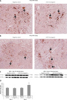 https://www.archivesofmedicalscience.com/f/fulltexts/112326/AMS-19-3-112326-g008_min.jpg