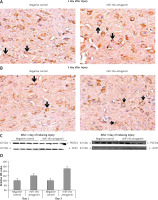 https://www.archivesofmedicalscience.com/f/fulltexts/112326/AMS-19-3-112326-g009_min.jpg