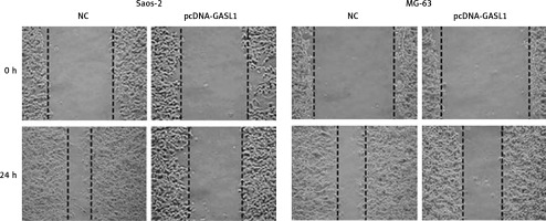 https://www.archivesofmedicalscience.com/f/fulltexts/112723/AMS-19-3-112723-g004_min.jpg