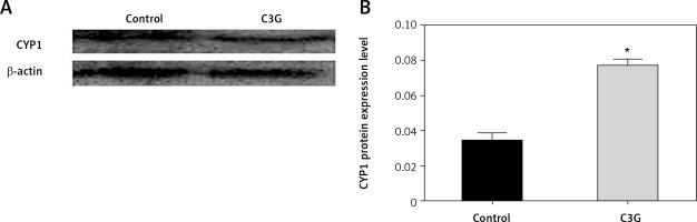 https://www.archivesofmedicalscience.com/f/fulltexts/113024/AMS-19-4-113024-g004_min.jpg