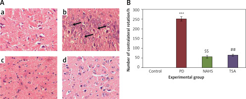 https://www.archivesofmedicalscience.com/f/fulltexts/113025/AMS-19-4-113025-g001_min.jpg